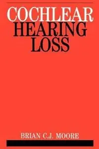 Cochlear hearing loss